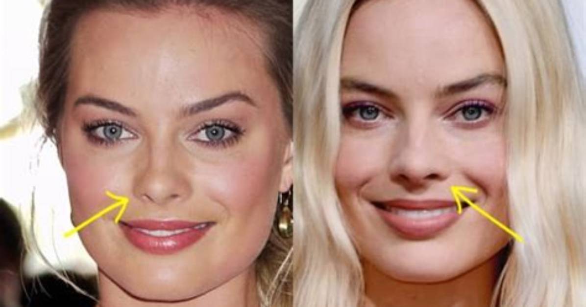 Margot Robbie Botox and Nose Job – Did She Get Surgery? Before and After