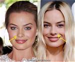 Margot Robbie Botox and Nose Job – Did She Get Surgery? Before and After