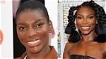 Michaela Coel's Fibroid Surgery Journey