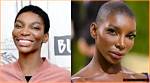 Michaela Coel's Journey: Exploring Fibroids and Recovery