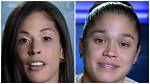 Nany Gonzalez Before and After Veneers Transformation Is Astonishing