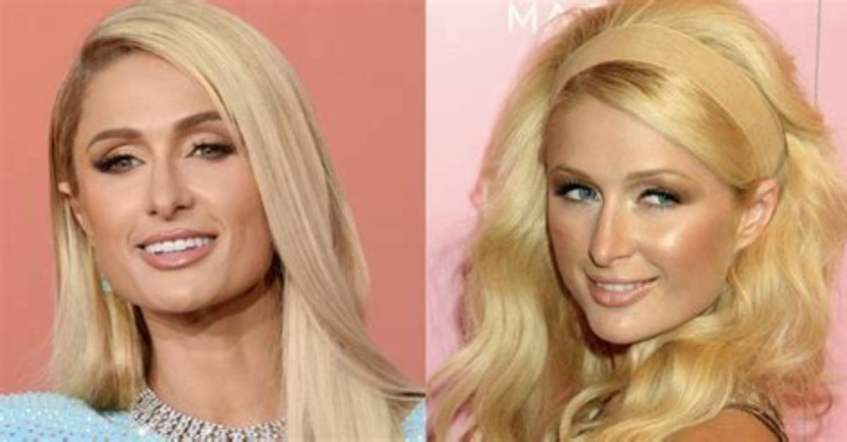 Paris Hilton's Cosmetic Enhancements: Unraveling the Plastic Surgery Journey