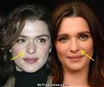 Rachel Weisz Plastic Surgery: Did She or Didn't She?
