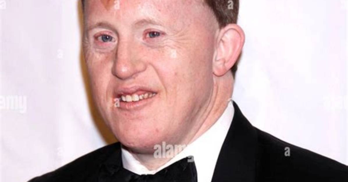 Remembering Chris Burke: a Tribute to His Life and Legacy