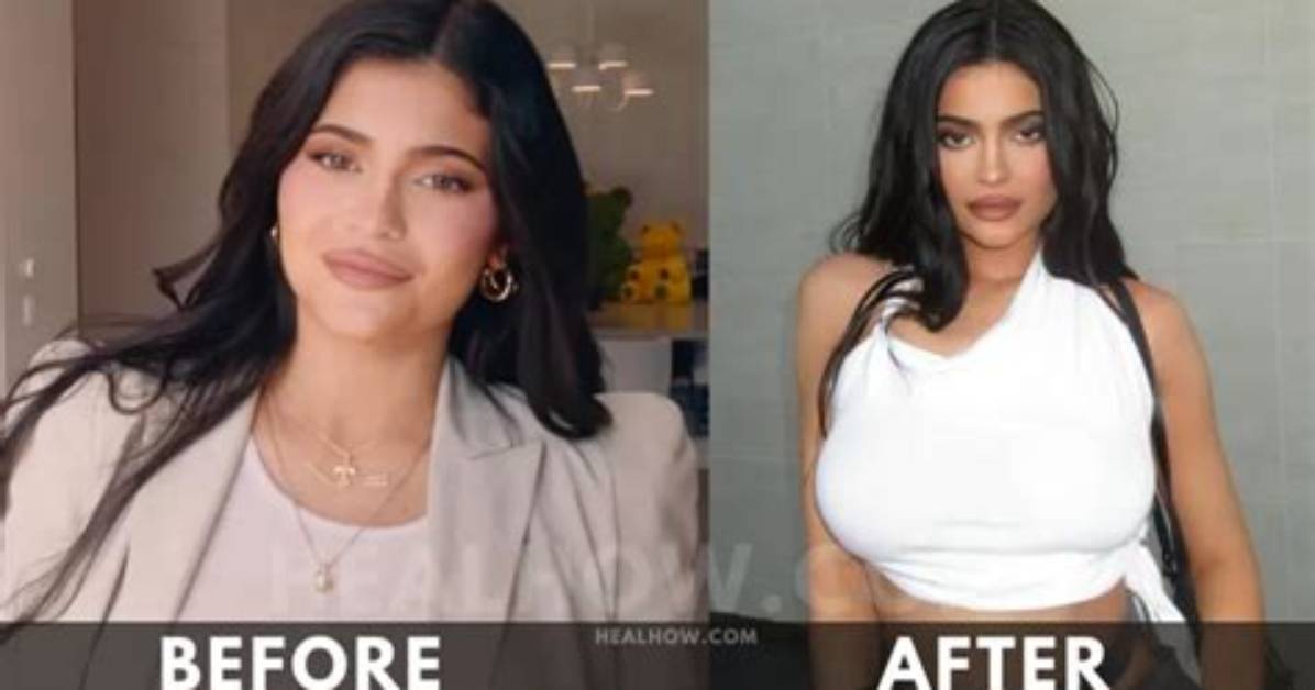 Revealing Kylie Jenner's Weight in 2024: a Glimpse into Her Transformation