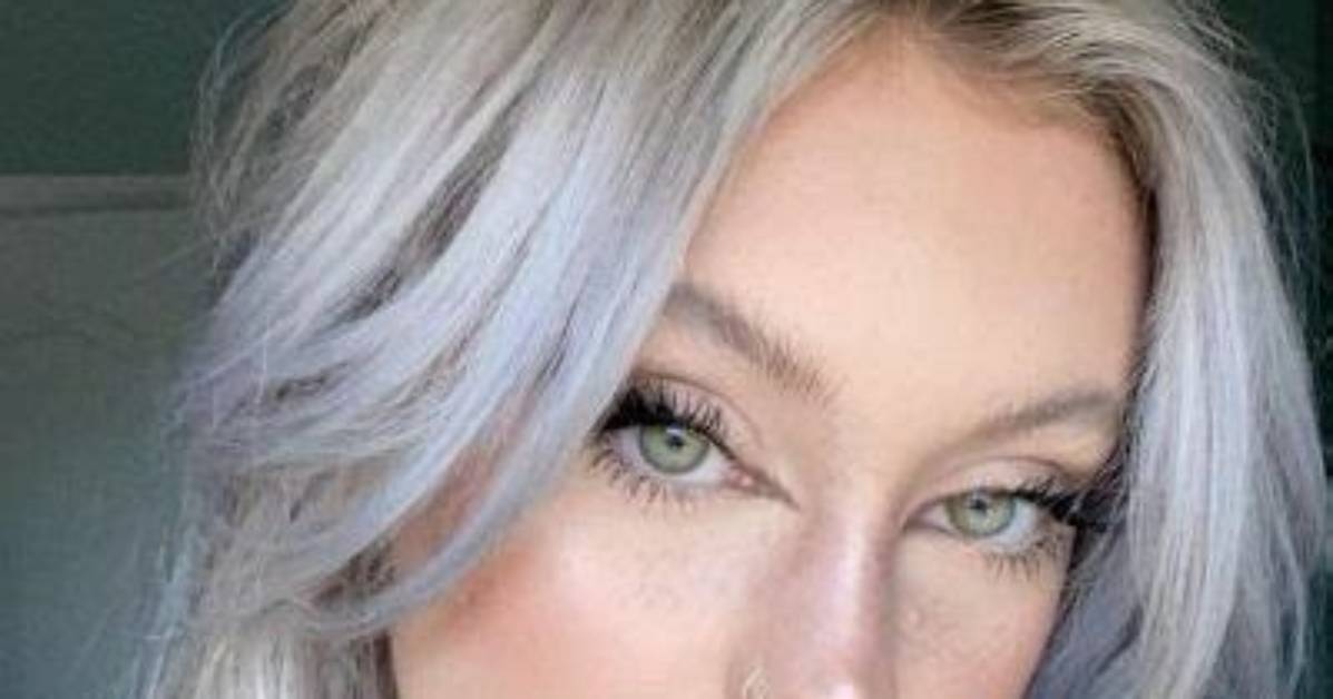 Riley Hubatka Had Plastic Surgery to Repair Her Broken Nose
