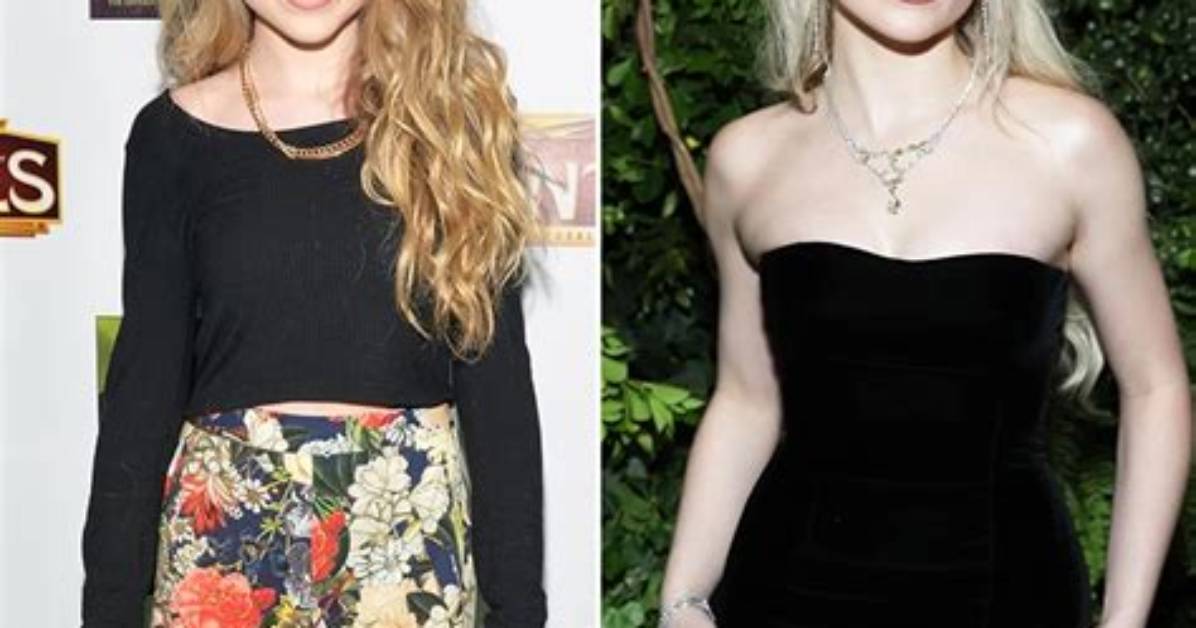 Sabrina Carpenter: a Journey Through Change - Before Plastic Surgery