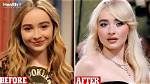 Sabrina Carpenter Before Plastic Surgery: a Journey Through Time