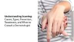 Seal Scarring: Causes, Treatment, and Prevention