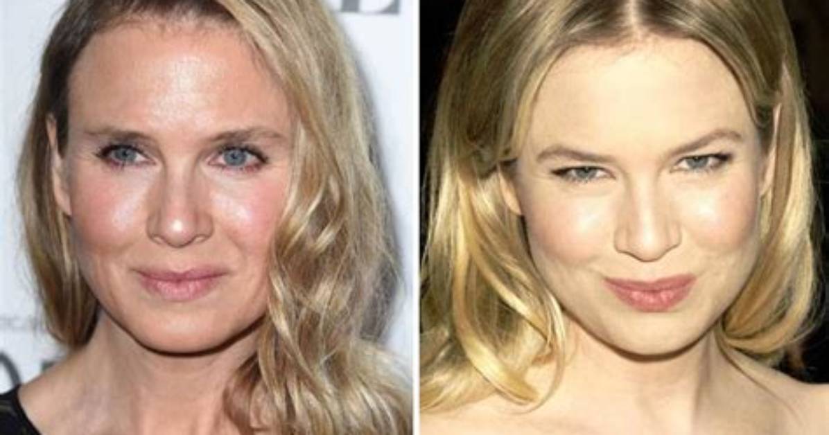 Stunning Photos of Rene Zellweger: Capturing Her Essence