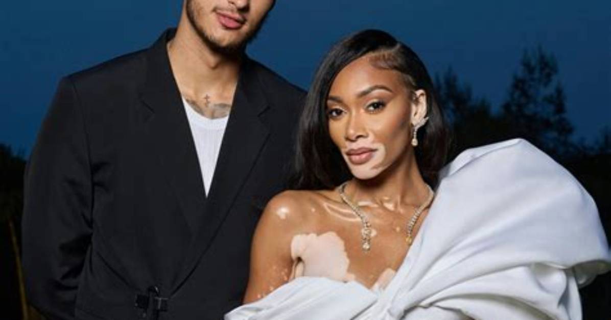 The Astonishing Evolution of Winnie Harlow's Vitiligo Journey