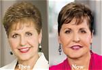 The Joyce Meyer Facelift Unveiled