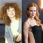 The Stunning Transformation: Nicole Kidman's Post-Surgery Journey