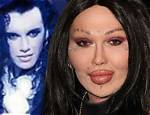 The Tragic Death of Pete Burns: a Musical Icon Lost