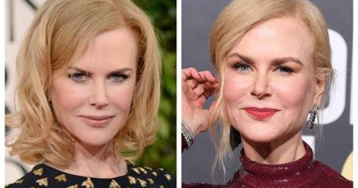 The Truth Revealed: Has Nicole Kidman Undergone Plastic Surgery?