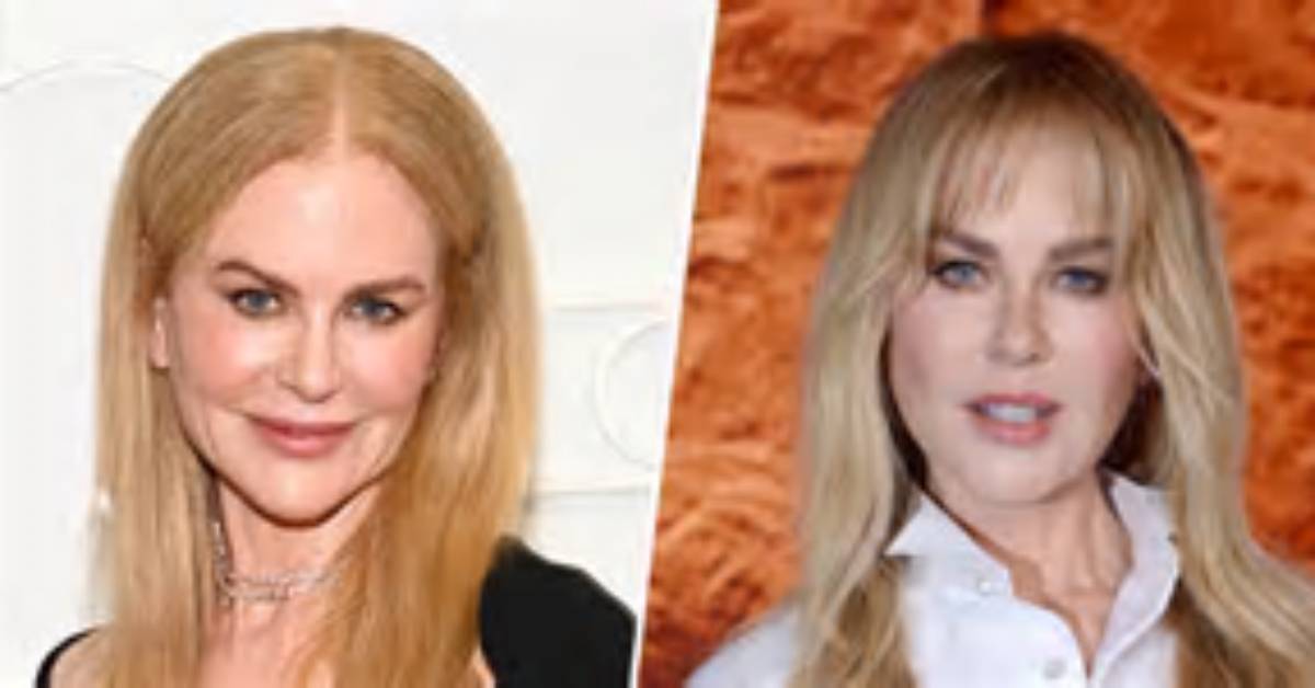 The Ultimate Guide to Nicole Kidman's Facelift: Before and After Comparisons