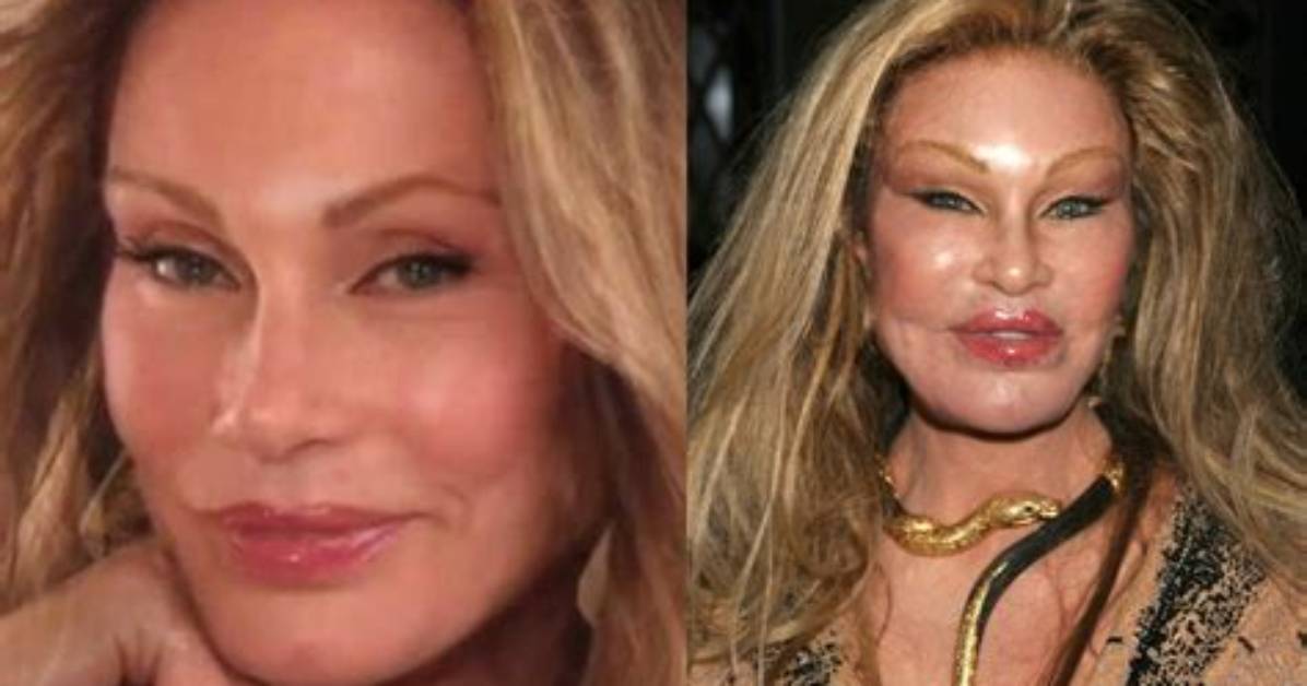 The Unbelievable Transformation of Jocelyn Wildenstein: the 'Cat Lady'