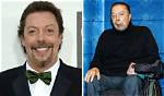 Tim Curry's Medical Condition: Uncovering Discoveries and Insights