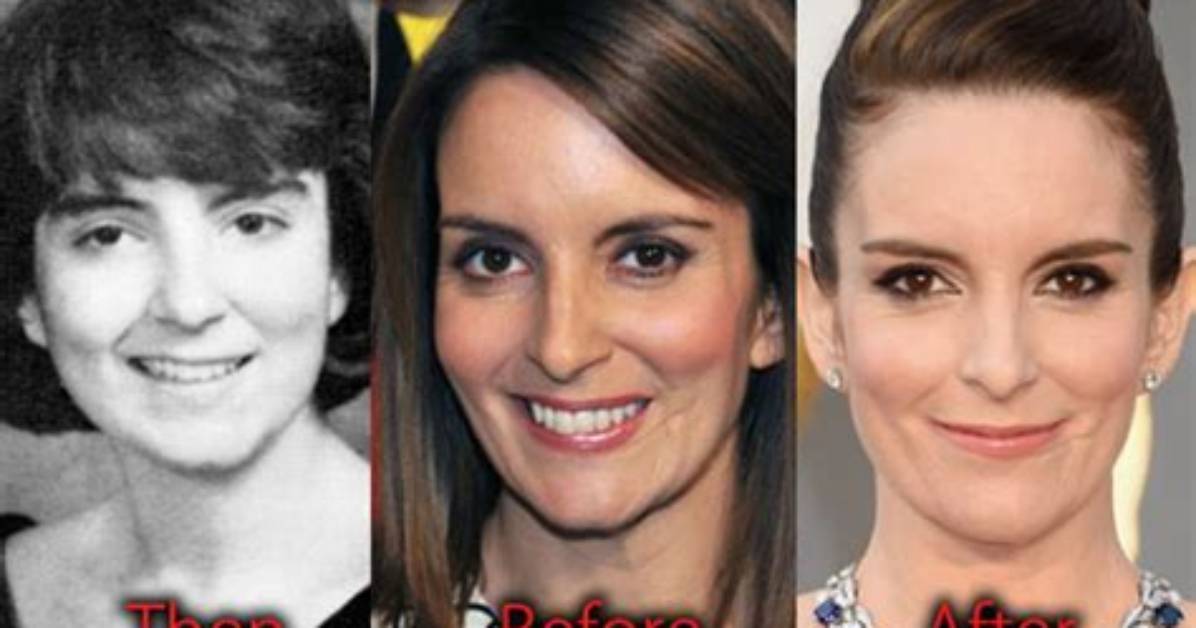 Tina Fey's Face Surgery: a Comprehensive Guide