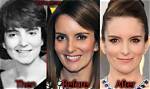 Tina Fey's Face Surgery: a Comprehensive Guide
