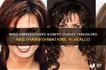 Transformations Revealed: the Journey of Actress Plastic Surgery Before and After