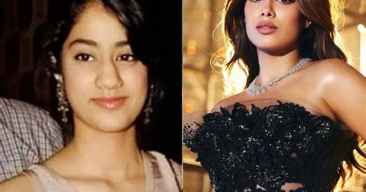 Transformations Unveiled: Heroines Before and After Plastic Surgery