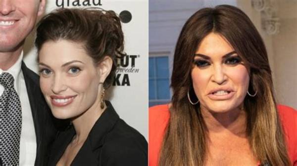 Transformative Journey: Guilfoyle Before and After