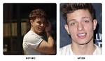 Transformative Smile: Matt Rife Teeth Before and After