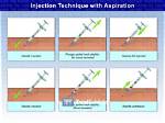 Ultimate Guide to Aspirate Needle Injection: Techniques and Applications