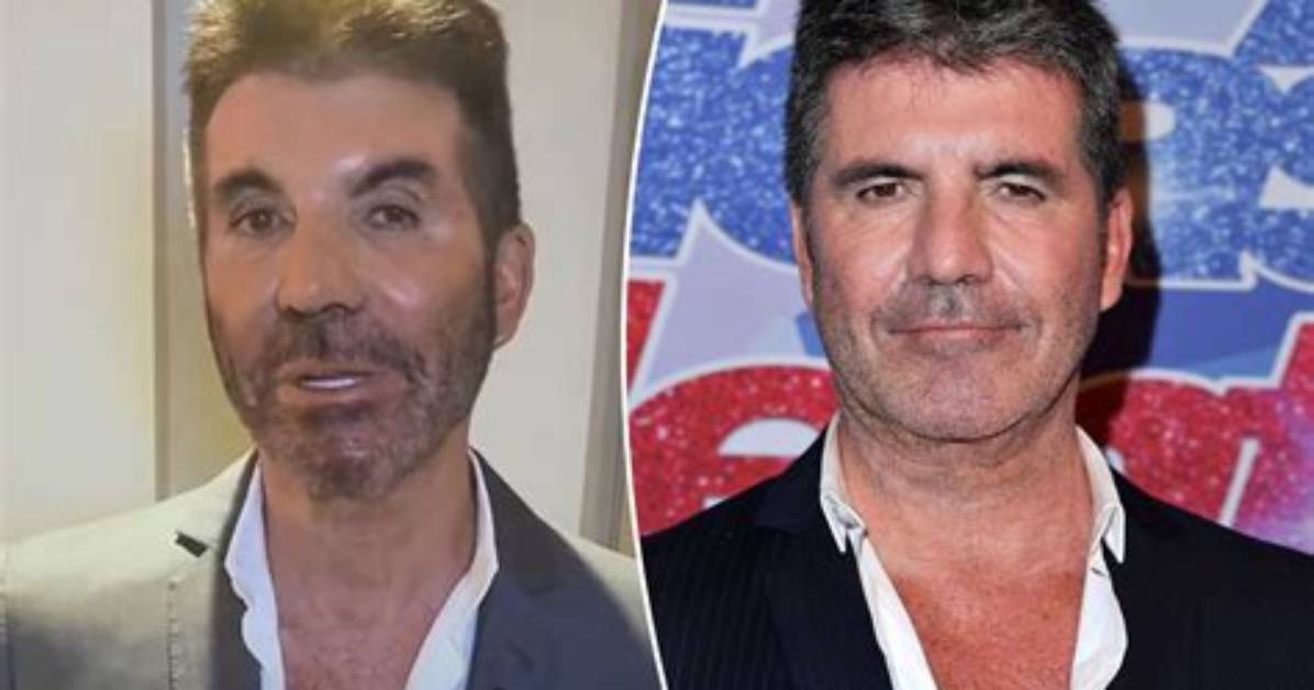 Uncover the Ailment Affecting Simon Cowell's Son: a Comprehensive Guide