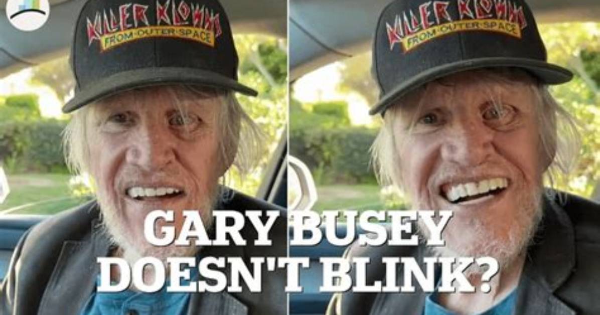 Uncovering the Truth Behind Gary Busey's Mysterious Eye Injury