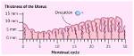 Understanding the Ideal Thickness of Uterine Lining for Successful Ivf: a Comprehensive Guide