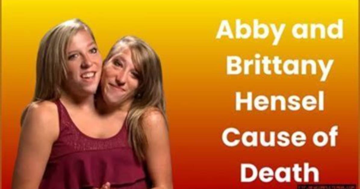 Understanding the Mystery Surrounding Abby and Brittany Hensel's Cause of Death