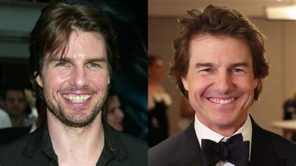 Unique Smiles: Exploring Actors with Underbites
