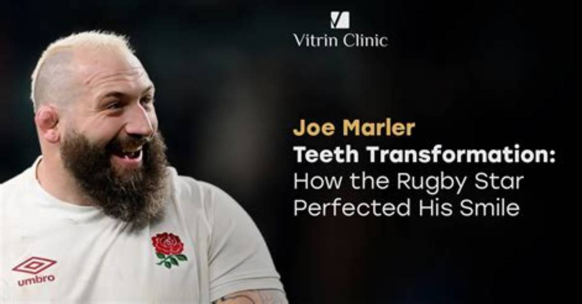 Unlocking the Secrets of Joe Marler's Remarkable Physique