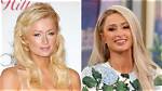 Unmasking the Truth: Did Paris Hilton Undergo Rhinoplasty?