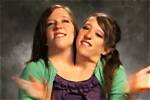 Unraveling the Mystery: Did the Hensel Twins Die?