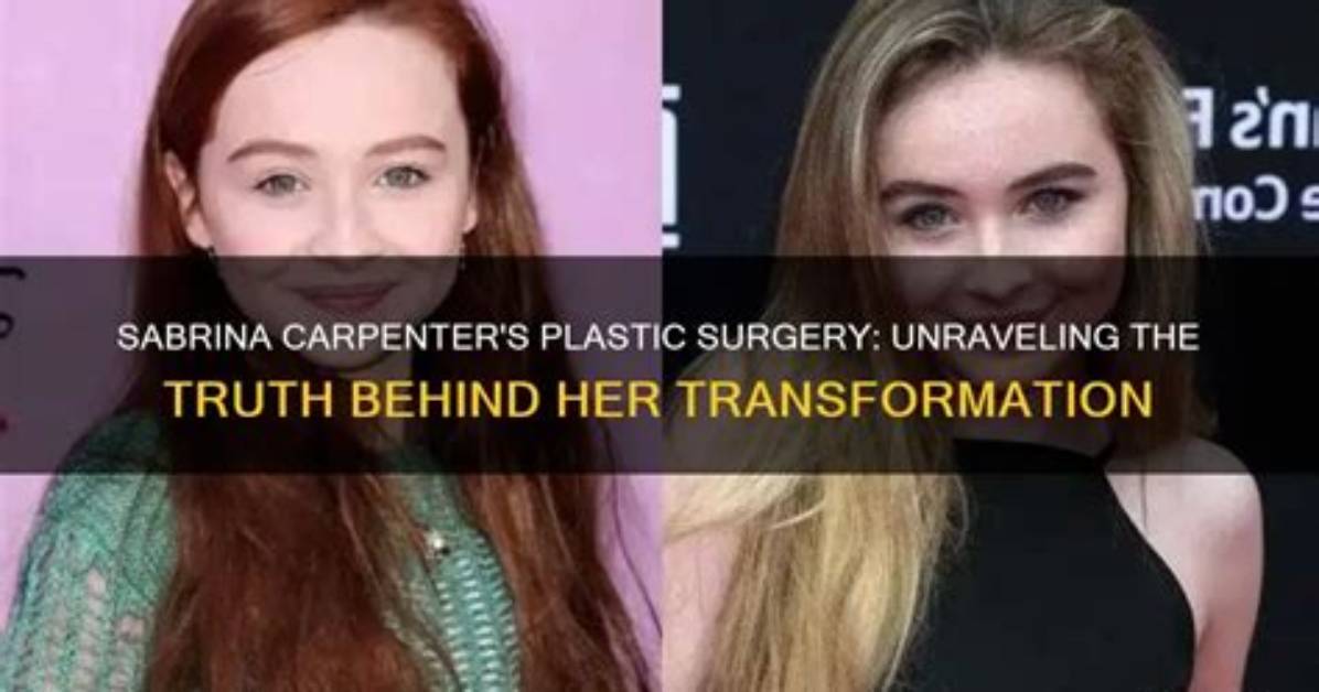 Unraveling the Mystery: Has Sabrina Had Plastic Surgery?