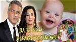 Unraveling the Truth: Does George Clooney Have a Down Syndrome Child?