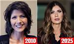 Unrecognizable! the Complete Transformation of Kristi Noem's Face