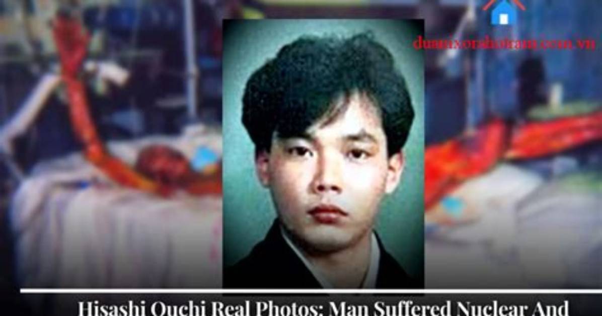 Unseen Photos of Hisashi Ouchi: a Tragic Reality Revealed