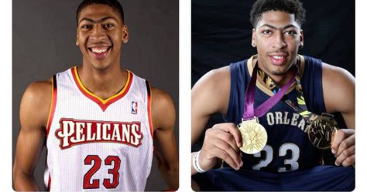 Unveiling Anthony Davis' Dental Transformation: Discoveries and Insights