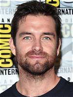 Unveiling Antony Starr: the Truth Behind His Plastic Surgery Rumors