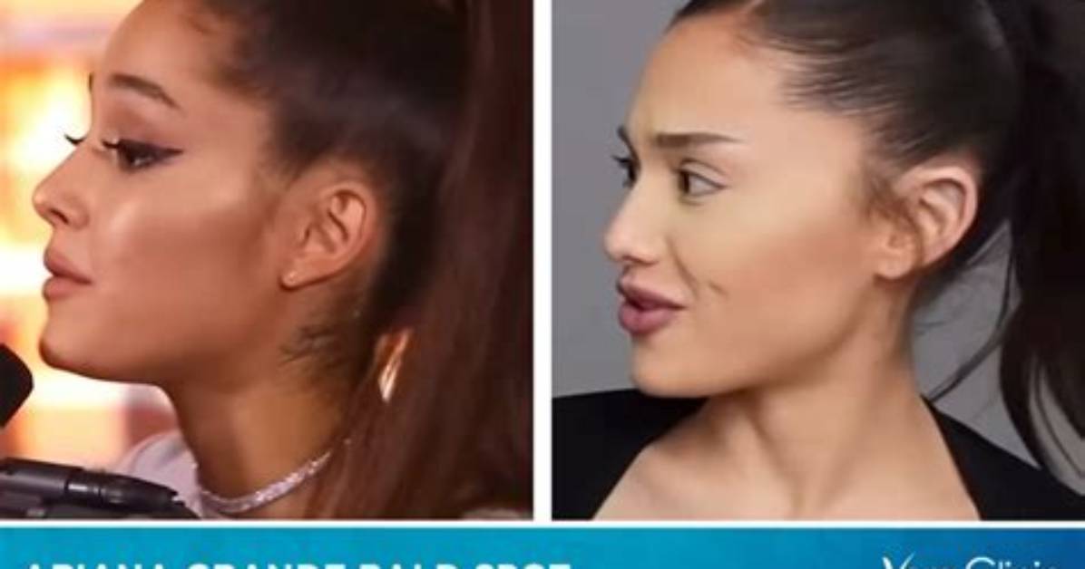 Unveiling Ariana Grande's Hair Loss Journey: Insights and Revelations