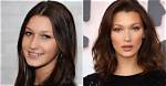 Unveiling Bella Hadid: a Glimpse Before Plastic Surgery