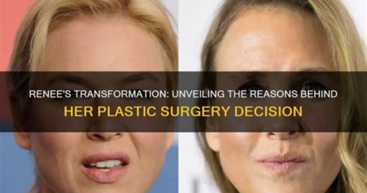 Unveiling Brandy Renee's Journey: Before Surgery Revelations