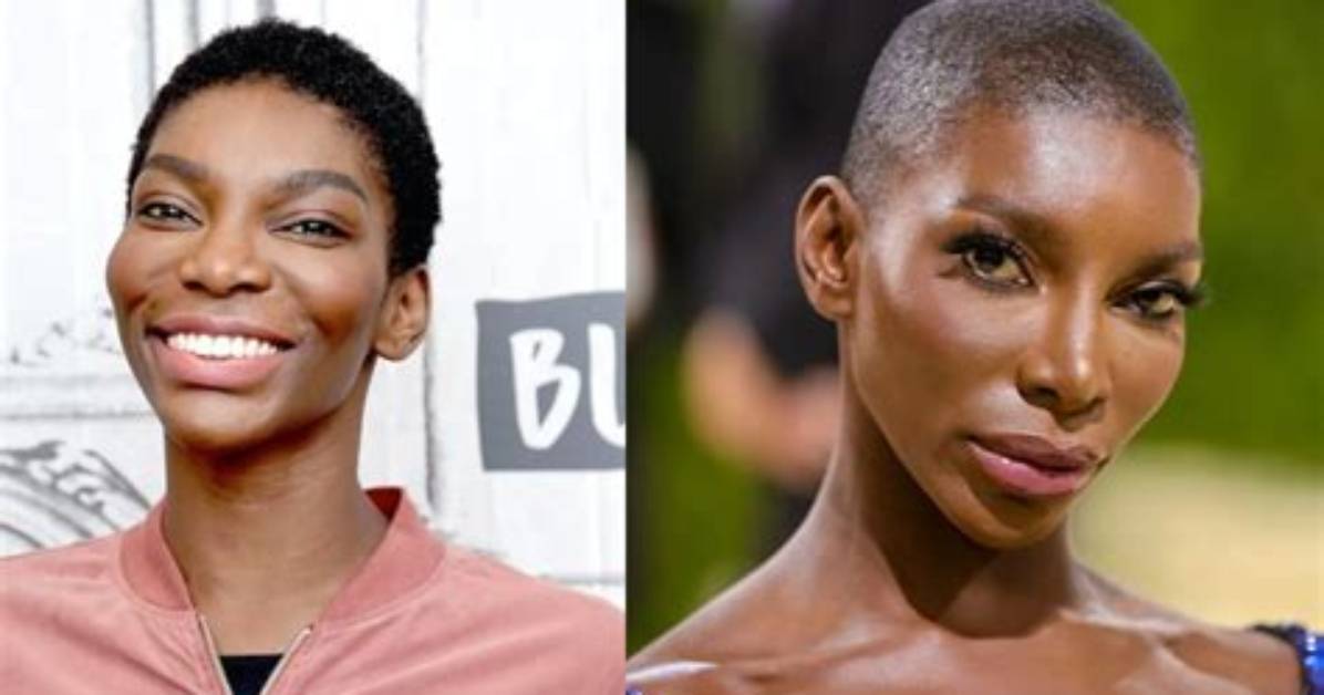 Unveiling Michaela Coel's Plastic Surgery Journey: Discoveries and Insights