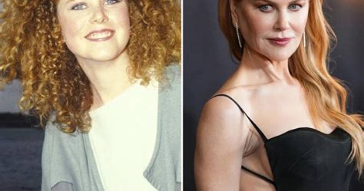 Unveiling Nicole Kidman's Radiant Transformation: a 2024 Facelift