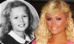 Unveiling the Before: Paris Hilton's Transformative Journey