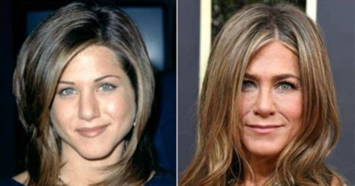 Unveiling the Enigma: Jennifer Aniston's Nose